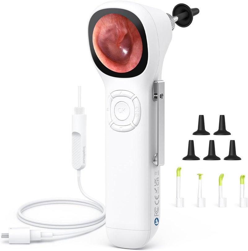 ScopeAround Digital Otoscope w/IPS Screen, 720p HD Smart Video Otoscope with Light, Ear Scope Otoscope with Camera Ear Wax Removal Camera, Ear Checker, Power On and Go, White - Image 1