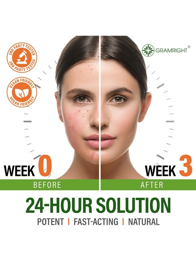 GRAMRIGHT Acne Treatment Face Cream - Acne Spot Treatment for Face & Acne Dots - Tea Tree Oil for Acne - Natural Cystic Acne Treatment -Made in USA- For All Skin Types - Acne Scar Cream & Pimple Remover 4 fl.oz - Image 3