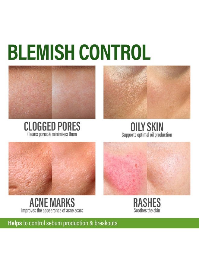 GRAMRIGHT Acne Treatment Face Cream - Acne Spot Treatment for Face & Acne Dots - Tea Tree Oil for Acne - Natural Cystic Acne Treatment -Made in USA- For All Skin Types - Acne Scar Cream & Pimple Remover 4 fl.oz - Image 4