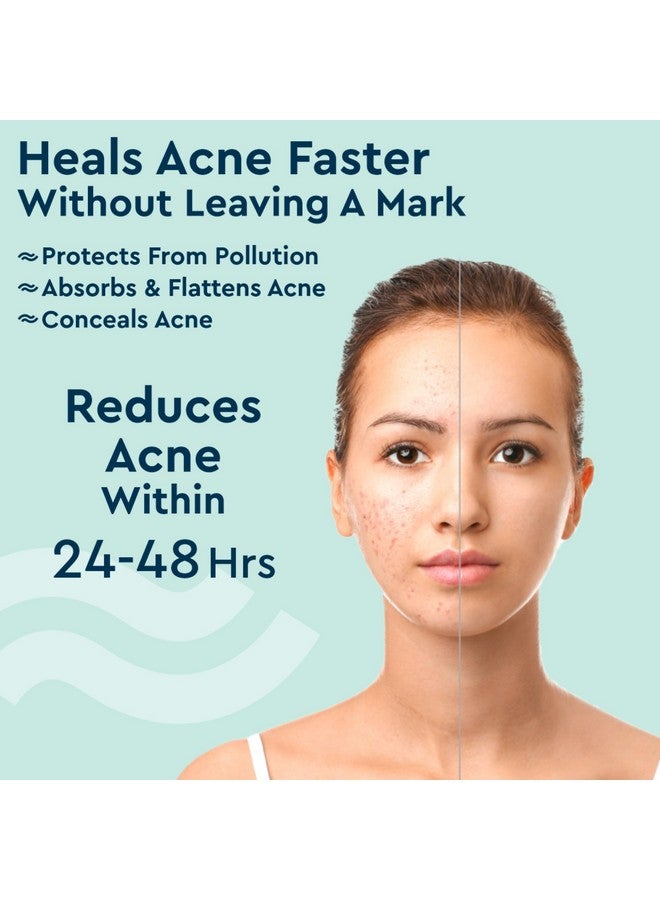 GUBB GUBB Acne Pimple Patches - Invisible Facial Stickers cover with 100% Hydrocolloid, Pimple Patches for Face, Acne Patches for Face (36 Pieces)  - Image 4