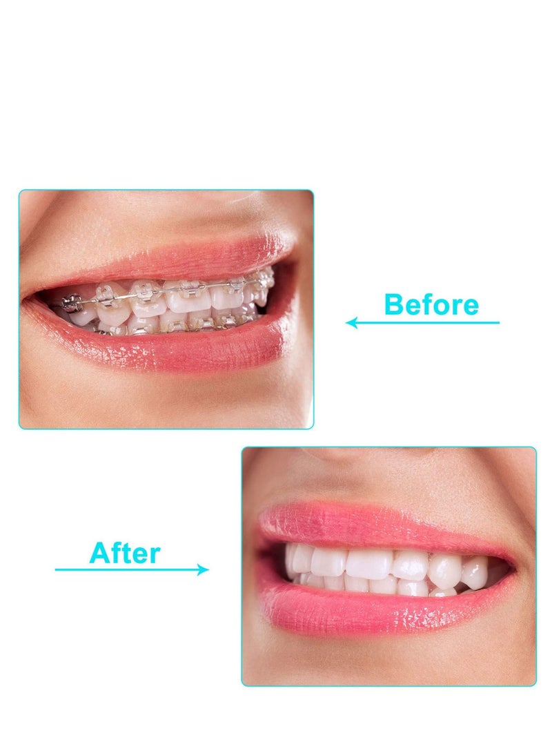 KASTWAVE 20 Piece Aligner Chewies Invisible Retainer Seater Orthodontic Silicone Tooth Stick Green - Image 4