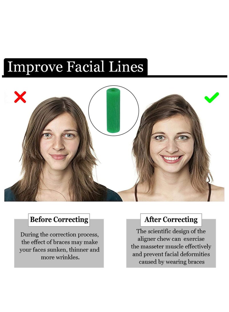 KASTWAVE 20 Piece Aligner Chewies Invisible Retainer Seater Orthodontic Silicone Tooth Stick Green - Image 5