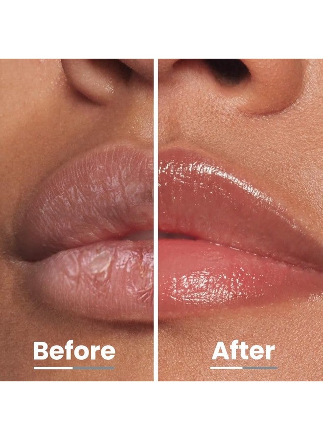 Hyphen All I Need Lipscreen With Spf 30 & 2% Kojic Acid - Moisturizing, Sun Protection | Hyphen | Smooth Lips, Tan Removal For Women And Men | Vegan, Sls & Paraben-Free - 10 Gm - Image 5