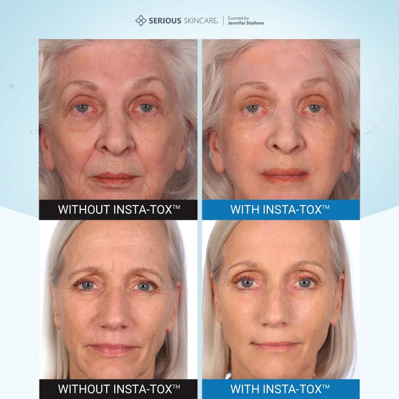 Serious Skincare INSTA-TOX Instant Wrinkle Filler for Face Serum, to Smooth + Blur Fine Lines, Deep Wrinkles, Lip Lines, Crowâ€™s Feet & Pores, Temporary Face Tightener, .75 oz - Image 3