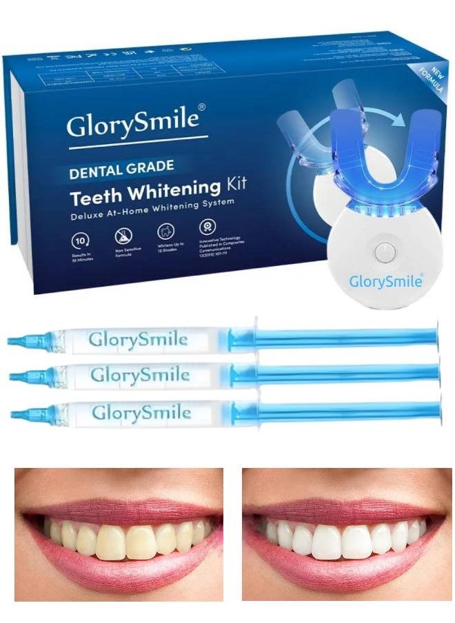 Teeth Whitening Kit with LED Light 10 Min Non Sensitive Fast Teeth Whitener with 3 Carbamide Peroxide Teeth Whitening Gel Helps to Remove Stains from Coffee Food - pzsku/ZB17EC80068AEC2FCD77AZ/45/_/1702646674/84e4fd59-9d8e-4045-b9c7-d8d0a1a0ebc2