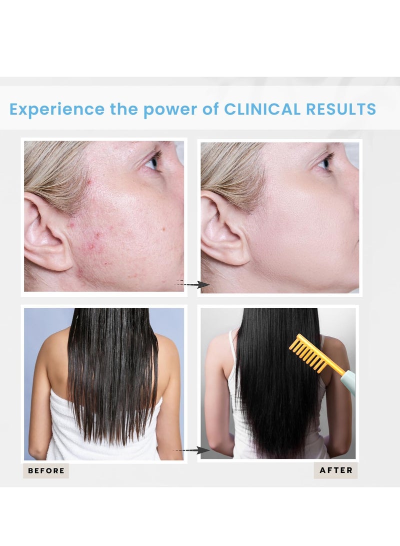 High Frequency Facial Machine - Portable Handheld High Frequency Facial Stick - Electric Comb/Neon Color - Image 4