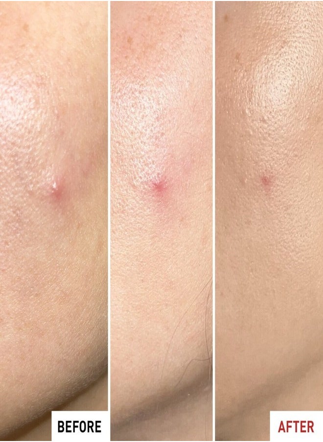 erborian ERBORIAN Centella SOS Patch Gel - Targeted Button Patch Effect for Blemishes 9ml  - Image 4