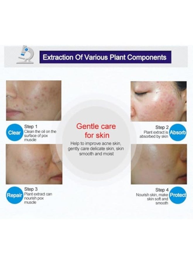 PUVIDA Acne Treatment Acne Control Cream for Face - Acne Gel Fast Absorbing Spot Treatment - Reduces Blemishes & Breakouts - Without Over Drying - Image 4