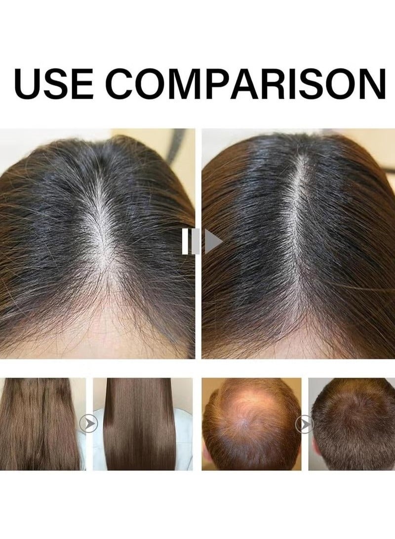 EELHOE Deoxyribose Sugar Gel Hair Growth, Hair Growth Oil, 60ml Deoxy Ribose Sugar Hair Growth Serums, Growing Hair Oil Scalp Gel For Hair Strengthening, Mild Hair Thickening Gel Safe Oil for Men Women - Image 5