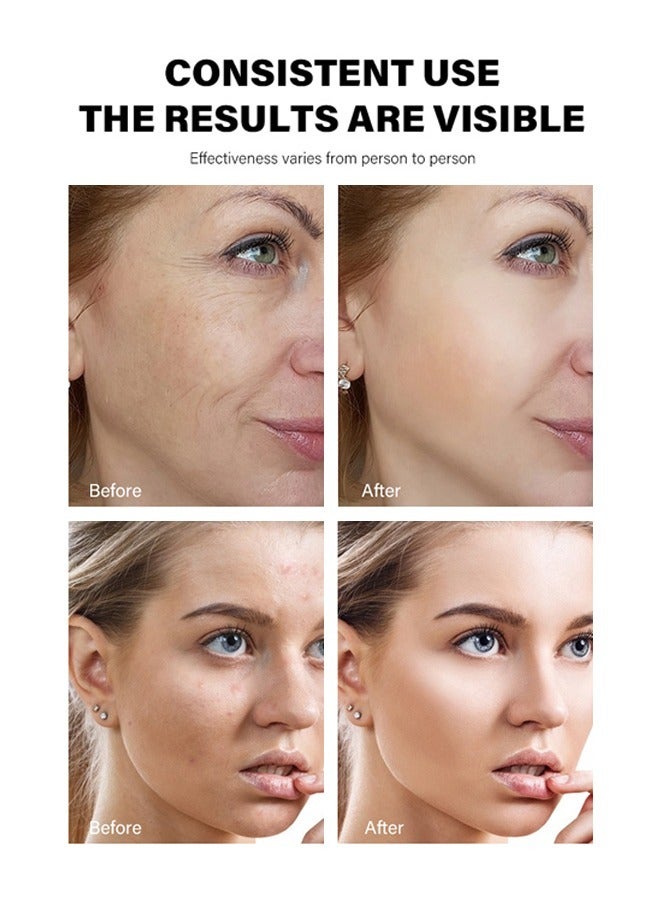 MOIKA Retinol Cream AHA 30% & BHA 2%，Anti-Aging Retinol Cream For Skin Renewing And Cure Enlarged Pores 30g - Image 2