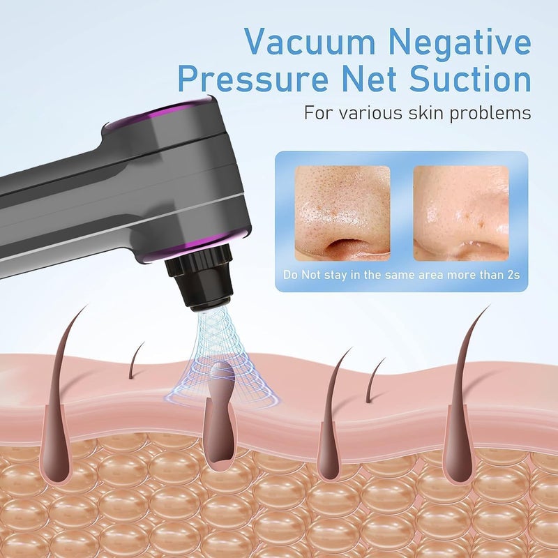 DOCOSS Ultrasonic Black head Remover Tool with Heating Mode -Rechargeable White heads & Blackhead Removal Machine for Nose with 5 Suction Levels and Probes, 2 in 1 Pore Cleaner for Brighter Face - Image 5