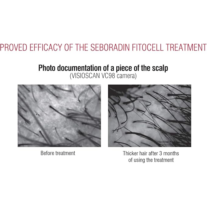 Seboradin Hair Loss and Regrowth Fitocell Shampoo with Swiss Technology Stem Cells Phytocelltec Malus Domestica and Biotin, for Men and Women, 200 ml - Image 3