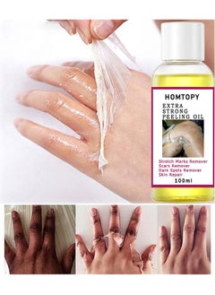 HOMTOPY Yellow Peeling Oil Super Strength Dead Skin Remover Skin Moisturizing Hydrating Butter Peeling Remove Dead Skin and Calluses on Feet and Hand Dark Spot Peeling Oil 100ml  - Image 1