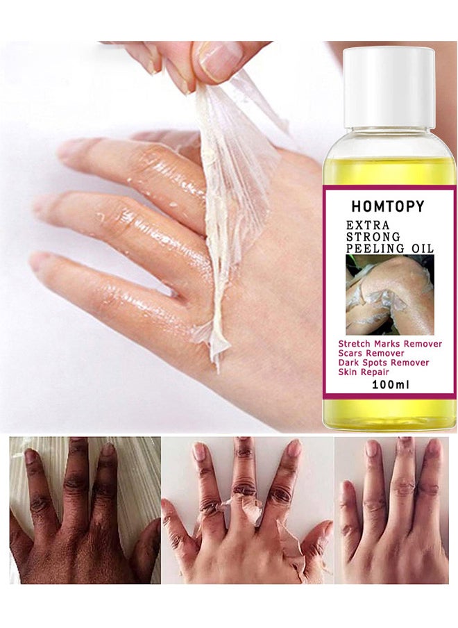 HOMTOPY Yellow Peeling Oil Super Strength Dead Skin Remover Skin Moisturizing Hydrating Butter Peeling Remove Dead Skin and Calluses on Feet and Hand Dark Spot Peeling Oil 100ml  - Image 1