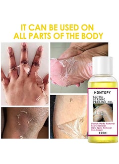 HOMTOPY Yellow Peeling Oil Super Strength Dead Skin Remover Skin Moisturizing Hydrating Butter Peeling Remove Dead Skin and Calluses on Feet and Hand Dark Spot Peeling Oil 100ml  - Image 2