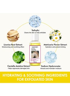 HOMTOPY Yellow Peeling Oil Super Strength Dead Skin Remover Skin Moisturizing Hydrating Butter Peeling Remove Dead Skin and Calluses on Feet and Hand Dark Spot Peeling Oil 100ml  - Image 5
