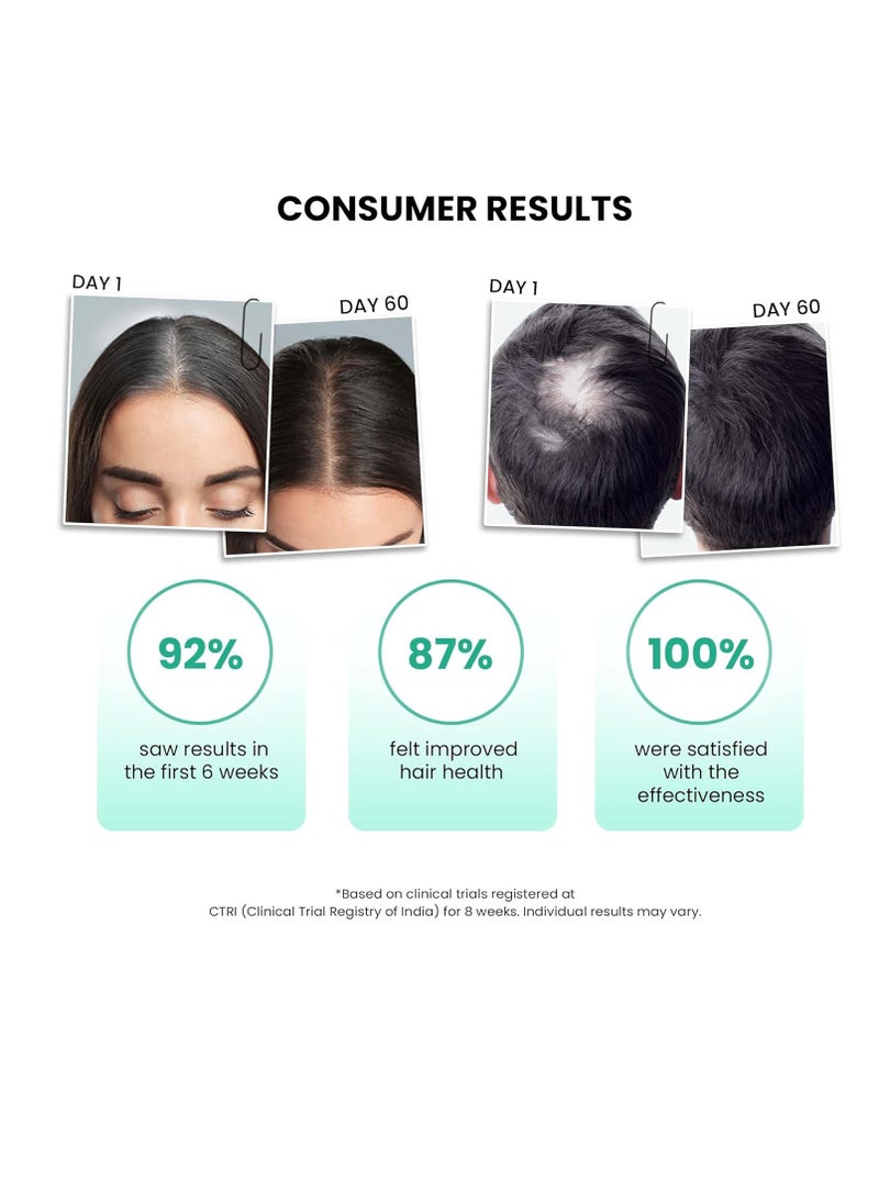 THRIVECO - Anti Grey Hair Prime Serum  Reverses Limits Hair Greying  Arcolys  Biotin Black Tea Extract  Light Weight Non Sticky  Odourless  For Men and Women 50 Ml - Image 1