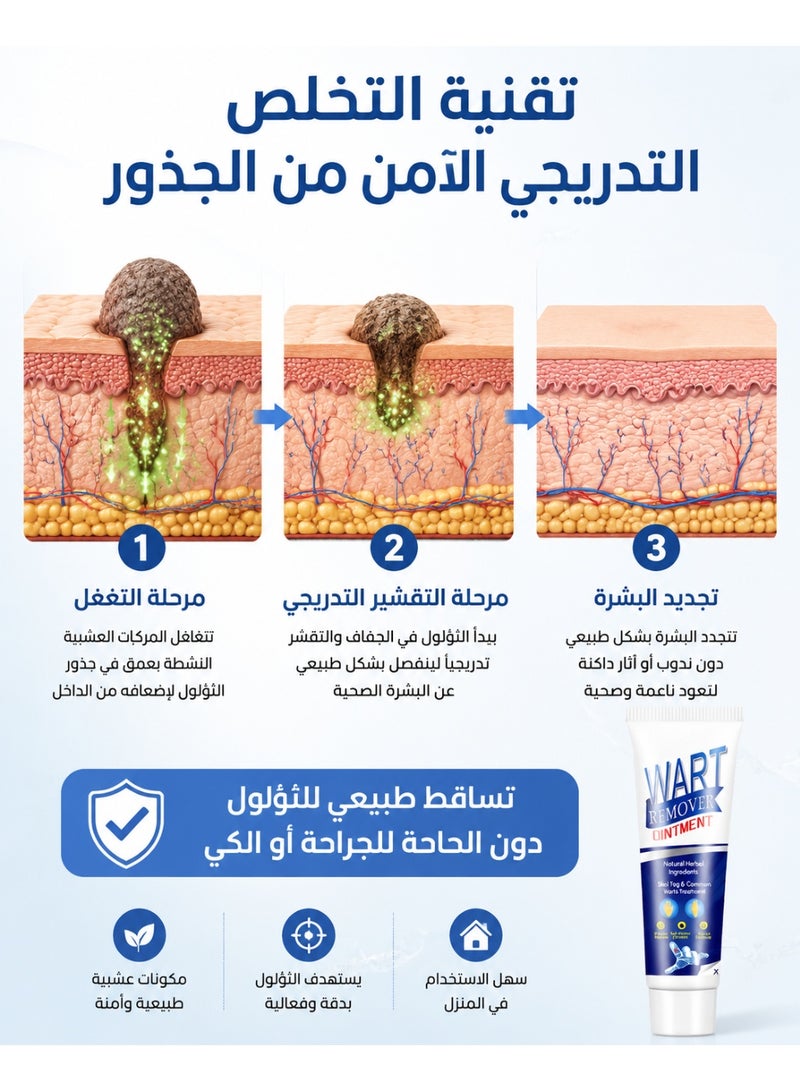 كريم مزيل الثآليل الطبيعي – إزالة فعالة وغير مؤلمة للثآليل ومسامير القدم – تركيبة عشبية لطيفة تعيد للبشرة نعومتها - Image 4
