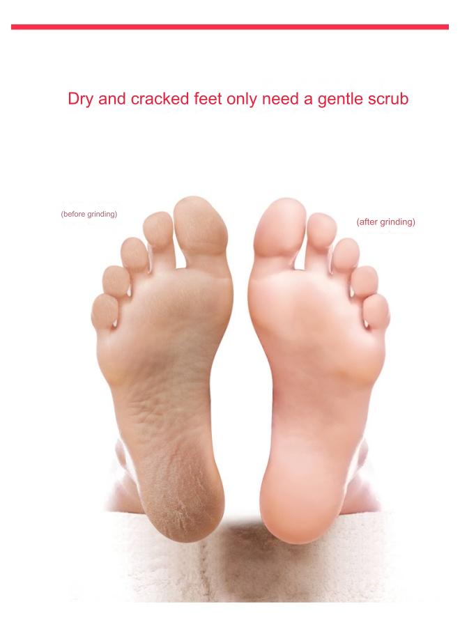 مبرد باديكير، أداة تنظيف القدمين، منظف القدمين على الوجهين، باديكير مسامير القدم لإزالة الجلد الميت، مطحنة القدم - Image 3