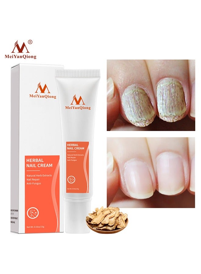ميان كيونج كريم الأظافر ، كريم العناية بالبشرة ، علاج الأظافر ، عشب ، أعشاب ، تصيد الأظافر ، والتصيد ، وإصلاحات ، وإصلاحات واستعادة الأظافر الرقيقة والمتصدعات والتقشير في أسابيع - Image 1