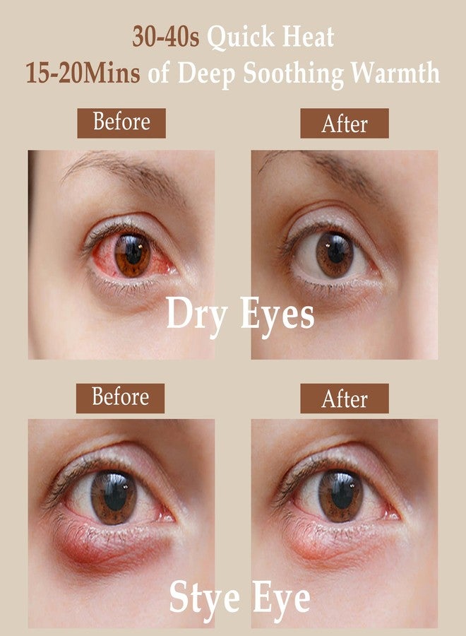 TOPOINT Heated Eye Mask (2-Packs), Moist Warm Compress Microwave with Flaxseed Cassia Seed, Weighted Eye Mask for Sleeping, Dry Eyes, Stye Eye Treatment, Relief Eye Fatigue (Black&Grey) - Image 3