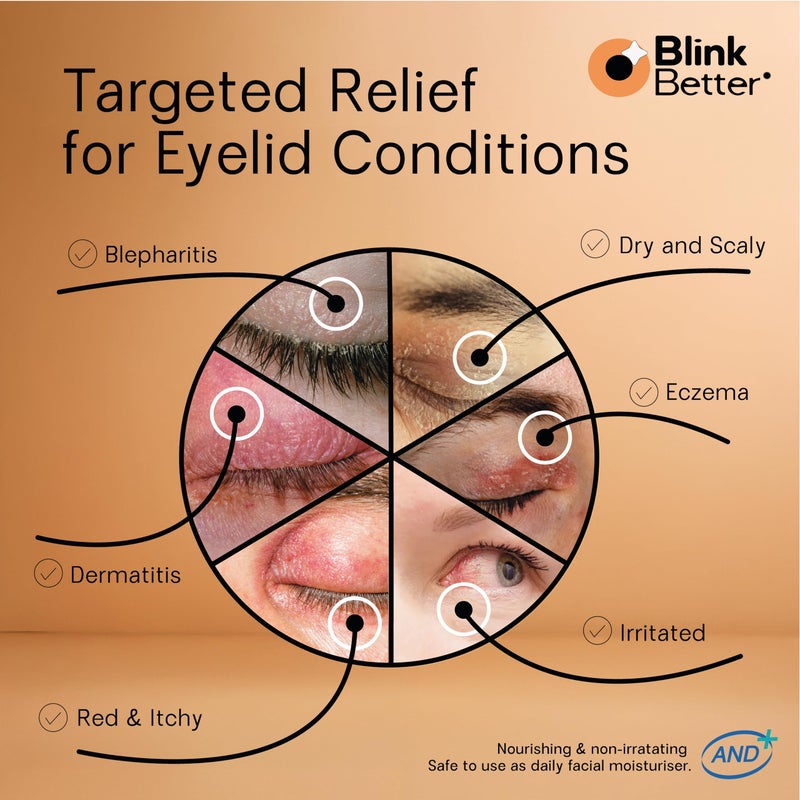 BlinkBetter BetterLids Restore Eyelid Cream â€“ Barrier Support to Hydrate, Soothe & Moisturise Dry, Itchy, Red & Sensitive Eyelids â€“ Lightweight Daily Formula with 3% Oat & Ceramides, 1 fl oz - Image 3
