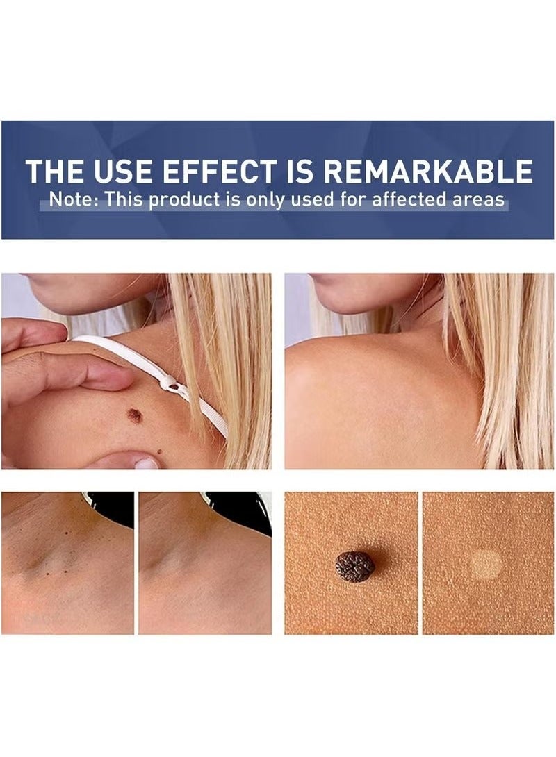 Lanthome Wart Remover, Fast Acting and Painless Skin Tag Remover Liquid, Tags and Mole Remover, Tag-Remover for Hands and Body, Wart Cream for Genital Warts, Plantar Wart, Common Wart, Corn, Flat Wart - Image 3