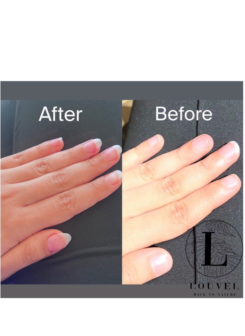LOUVEL - Nail lotion..Nail strengthening, more growth ,anti cracking,moisturizer cuticle - Image 1
