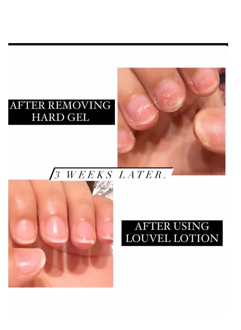 LOUVEL - Nail lotion..Nail strengthening, more growth ,anti cracking,moisturizer cuticle - Image 1
