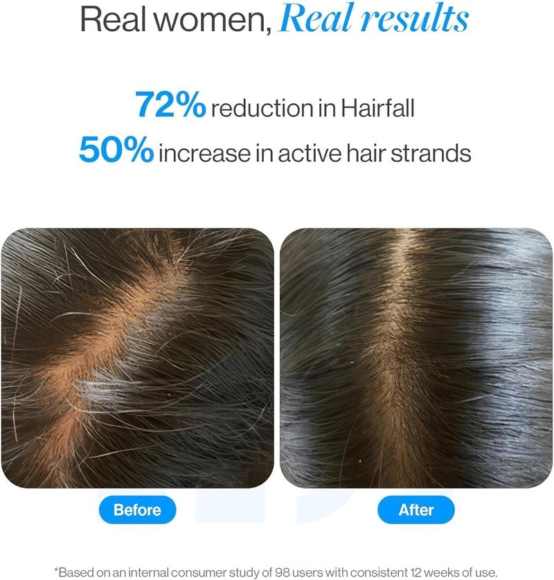 Be Bodywise 3% Rosemary Hair Serum (Roll On) 50ml | 3% Redensyl, 2% Aminexil & 2% Anagain | Thicker & Stronger Hair Growth | Prevents Hair Fall & Stimulates Hair Follicles | Pack of 2 - Image 4