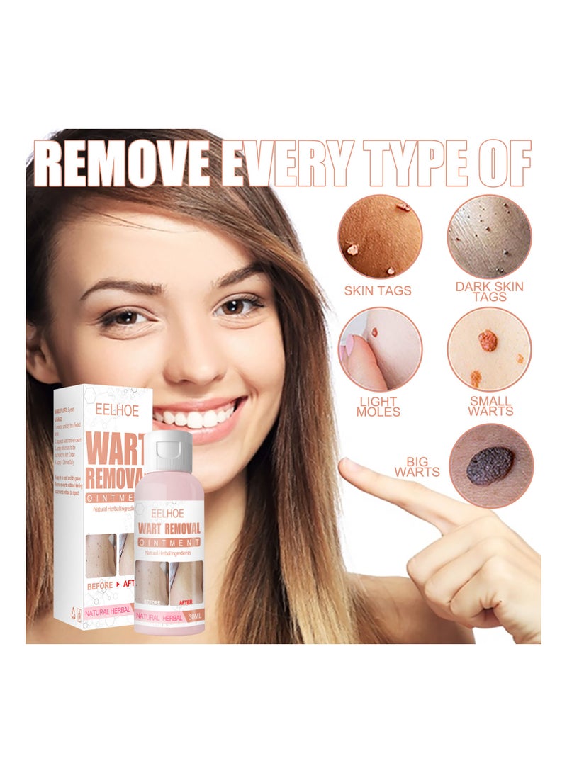 EELHOE Skin Tag Moles Wart Removal  - Image 4