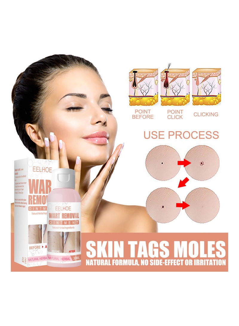 EELHOE Skin Tag Moles Wart Removal  - Image 3