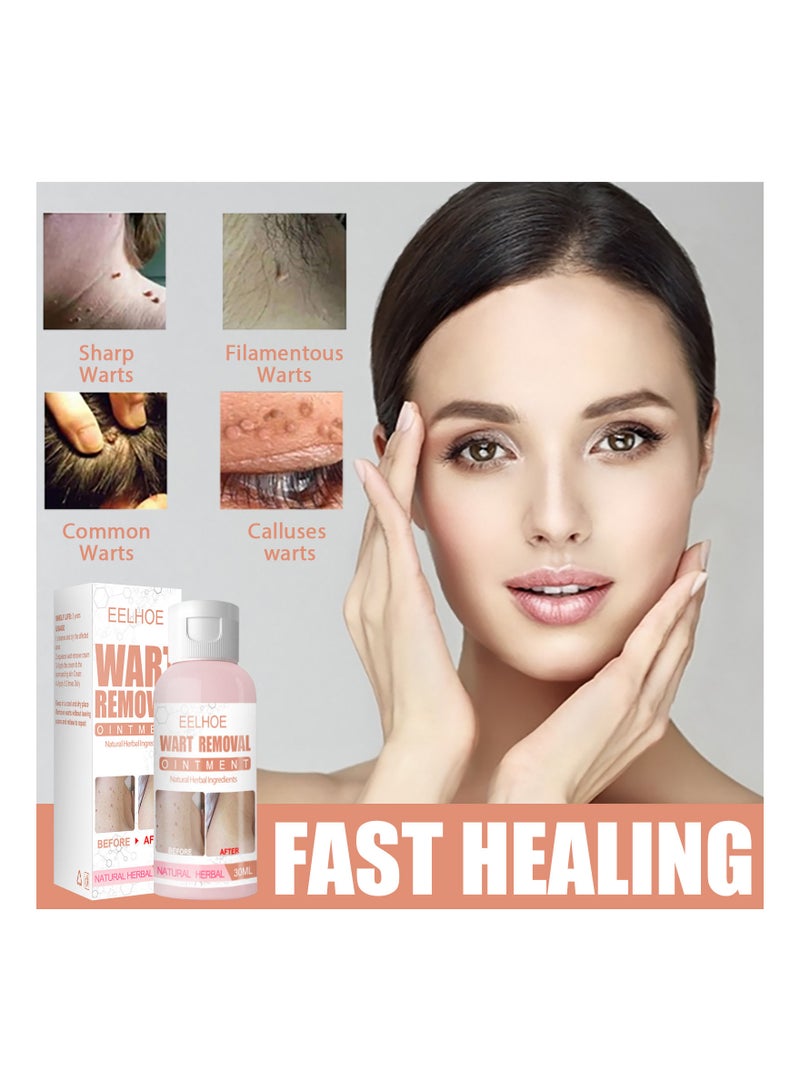 EELHOE Skin Tag Moles Wart Removal  - Image 2