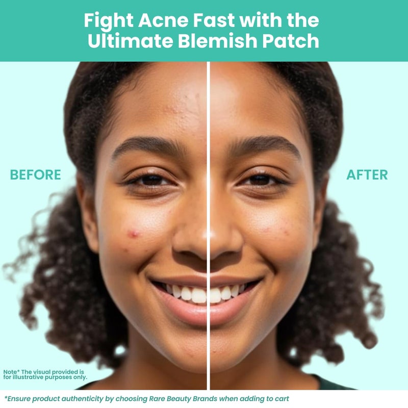 Patchology Breakout Box 3-in-1 Pimple & Acne Spots Treatment Patch Kit with 3 Nose Strips, 24 Salicylic Acid Dots, and 24 Hydrocolloid Dots - For Men and Women - Dark Spot Patches for Face - Image 5