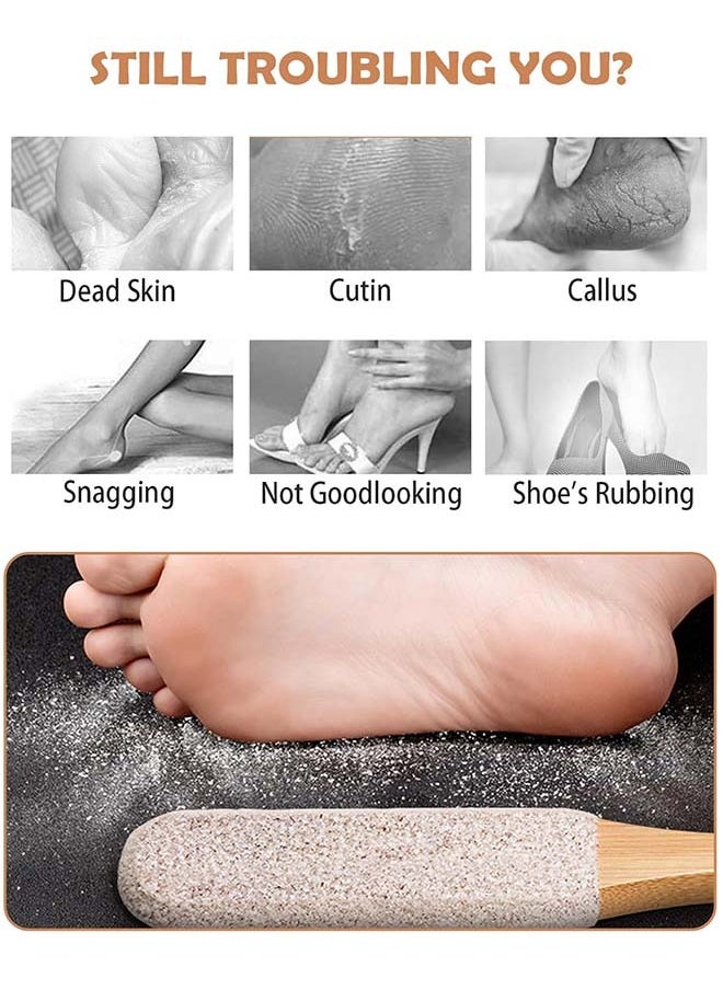 YIM-VIBEHAUS 2pcs Foot Hard Skin Remover Pedicure Foot Scrubber Callus Remover for Dead Skin Foot Care Pedicure Pumice Stone Pedicure Tool Foot File fit Wet and Dry Feet  - Image 2