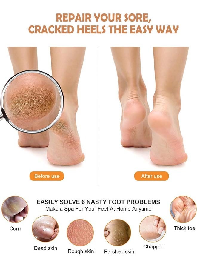 YIM-VIBEHAUS 2pcs Foot Hard Skin Remover Pedicure Foot Scrubber Callus Remover for Dead Skin Foot Care Pedicure Pumice Stone Pedicure Tool Foot File fit Wet and Dry Feet  - Image 3