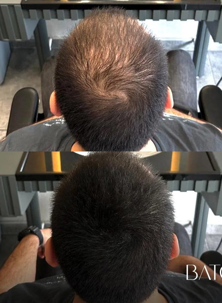 BATCI Hair Concealer Filling Cream for Bald Spots Thinning Hair Waterproof SweatProof Scalp Coverage Natural Root TouchUp Cream for Men Women 30ml - Image 4