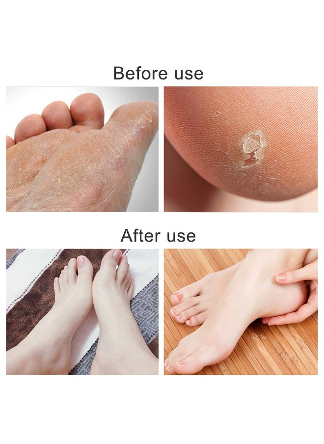 WISFOR Foot Scrubber Foot Files Callus Remover Black Heel Grater Dead Skin Remover Stainless Steel Heel Scraper for Cracked Heels  - Image 5