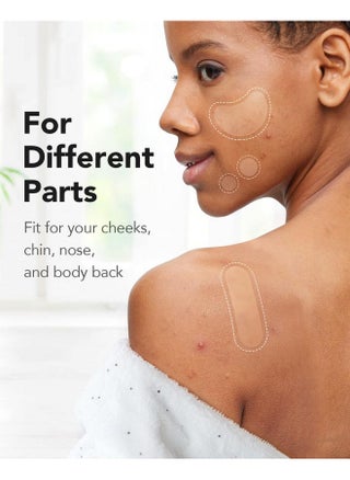 Acne Pimple Patch, 8 Sizes 140 Pcs Hydrocolloid Acne Patches With Storage Box, 24 Xl Pimple Patches For Face, Chin, Nose, 4 Shapes Zits Patches For Blemish, Dots With Tea Tree Oil & Cenrella - pzsku/ZB220FDCBD324E4F0995AZ/45/_/1734183278/3d529a7e-7926-407a-b6fb-1b1641db43ba