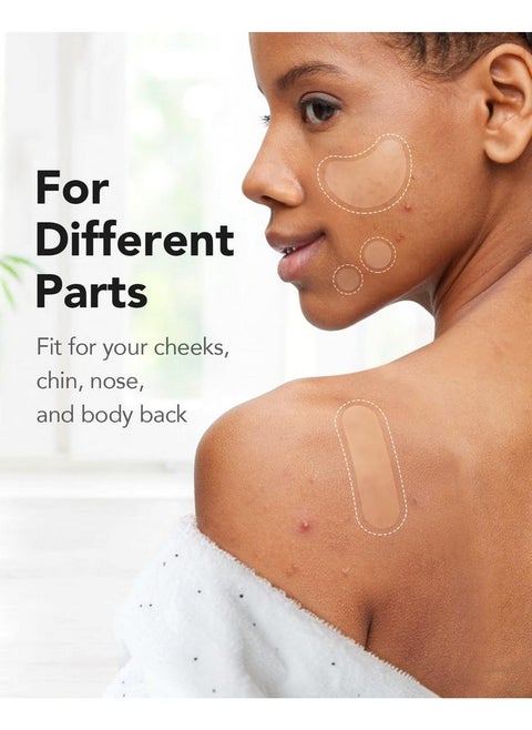 Acne Pimple Patch, 8 Sizes 140 Pcs Hydrocolloid Acne Patches With Storage Box, 24 Xl Pimple Patches For Face, Chin, Nose, 4 Shapes Zits Patches For Blemish, Dots With Tea Tree Oil & Cenrella