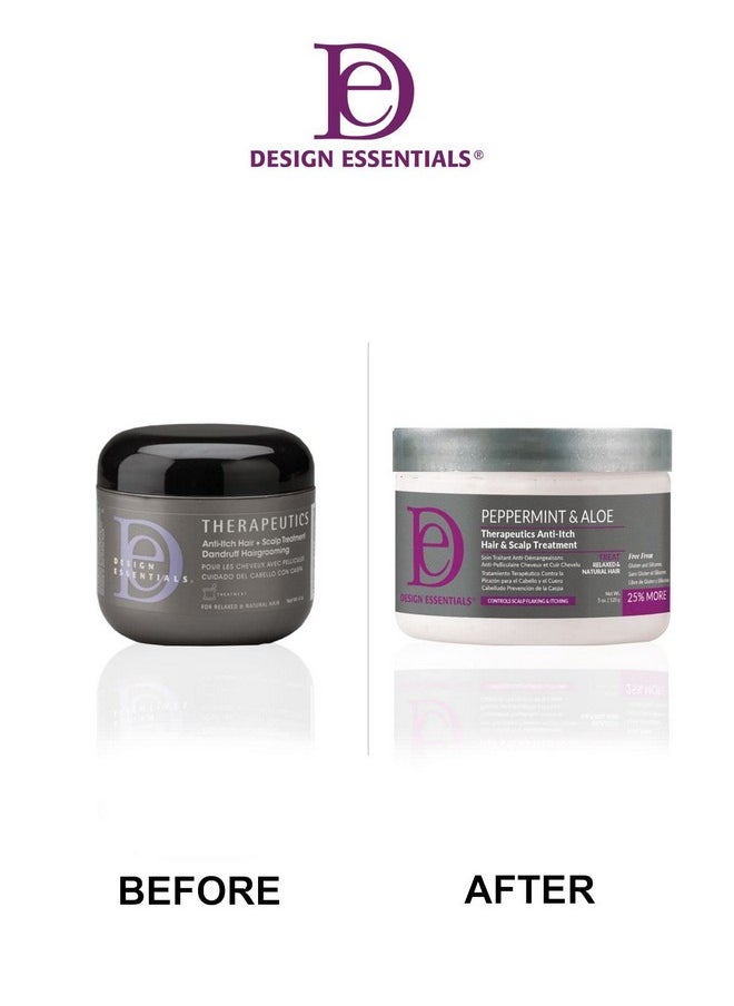 Design Essentials Design Essentials Peppermint & Aloe Therapeutics Anti-Itch Hair + Scalp Treatment Dandruff Hairgrooming, 5 Fl Oz., White  - Image 3