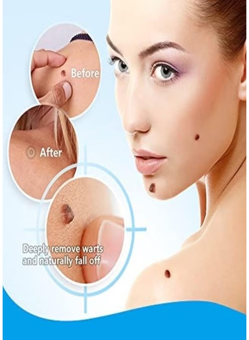 سوميفون كريم إزالة الثآليل – مزيل سريع المفعول للثآليل الجلدية والبشرة الناعمة الصافية - Image 2