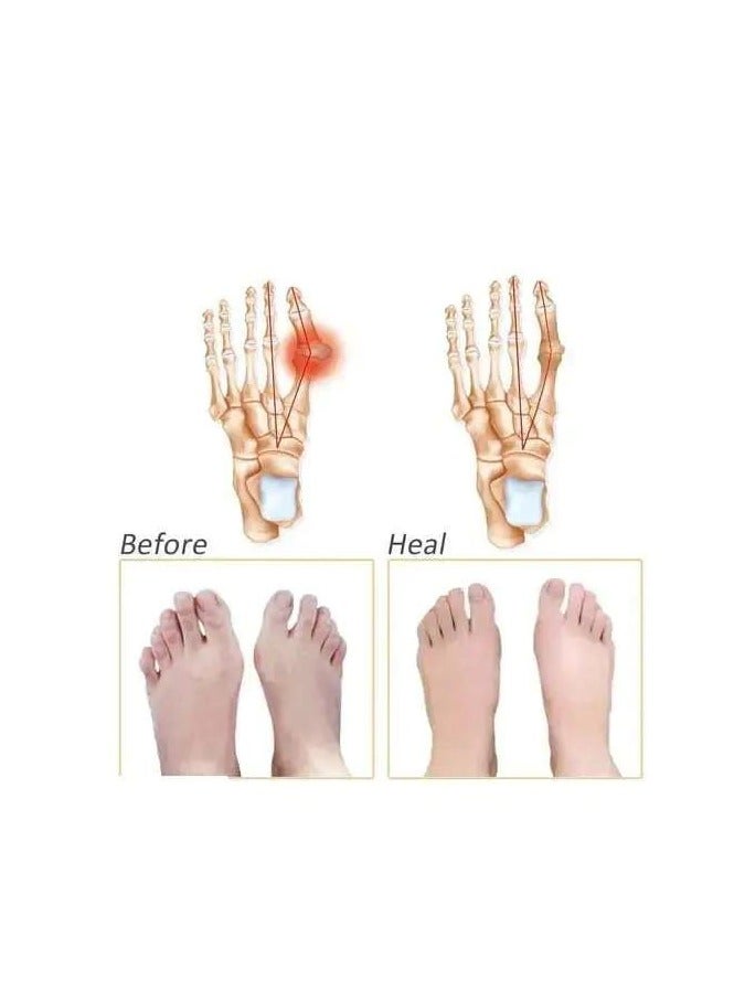 سيبوت وسادات سيليكون لمقدمة القدم - وسائد - لمشط - للنساء والرجال - جل - مقدمة من 4 قطع بلون ابيض زدبوم، مقاس واحد، يستخدم لتصحيح القوام. - Image 4