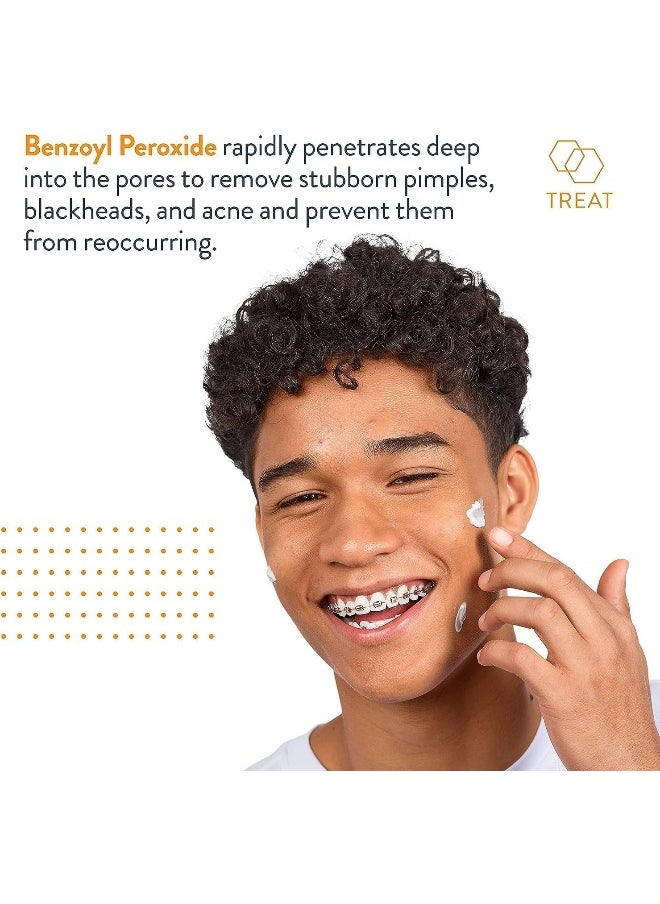 AcneFree Terminator 10 Acne Spot Treatment With Benzoyl Peroxide 10% Maximum Strength Acne Cream Treatment, 1 Ounce - Pack Of 1  - Image 4