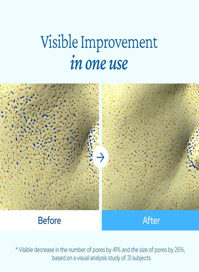 belif Aqua Bomb Cooling Relief Cream with Panthenol & Niacinamide - Daily Soothing & Hydrating Moisturizer, Depuff with Caffeine, Non-comedogenic, Lightweight Cream, Korean Skincare, 1.69 fl oz (50ml) - Image 5