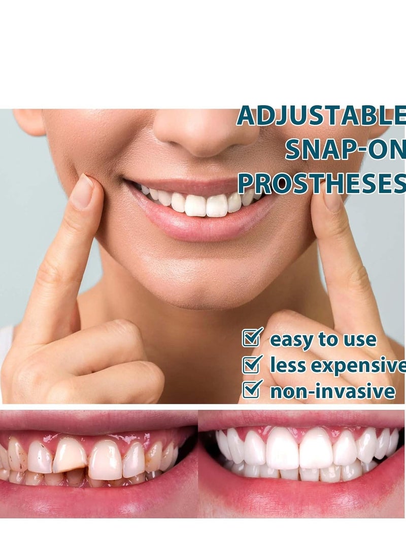 EELHOE 1 Pairs Temporary Teeth Perfect Cover, Cosmetic Veneers Teeth Temporary Dentures, Adjustable Snap On, Moldable False Teeth for Beautiful Smile, Nature and Comfortable, Fit Whitening Flex Den - Image 4