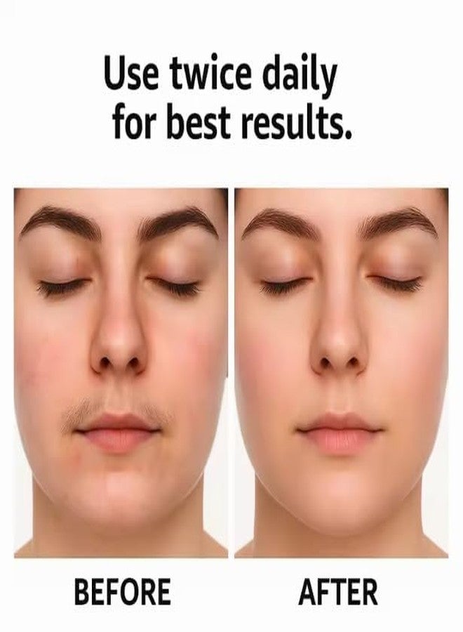 bricia Cyperus Rotundus Oil for Hair Removal - Gentle Natural Soothing Moisturizing Oil For Soothes Skin, Reduces Ingrown Hairs & Shrinks Pores, Moisturizing Formula - Image 3