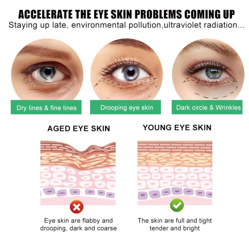 SORYA Eye Cream Remove Dark Circles Puffiness Eye Bags Wrinkles Fine Lines UnderEye Bags AntiAging Collagen Revitalize Your Look with Our Advanced Formula for a Youthful Glow - Image 5