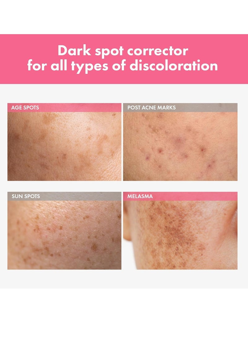 Tosowoong Arbutin 7% Intensive Spot Cream with 70,000ppm Arbutin, 3% Tranexamic Acid, 1% Niacinamide, Glutathione, Dark Spots, freckle, Blemishes, Anti-pigmetation, Korean Skin Care, 20ml, 0.67 fl.oz  - Image 2
