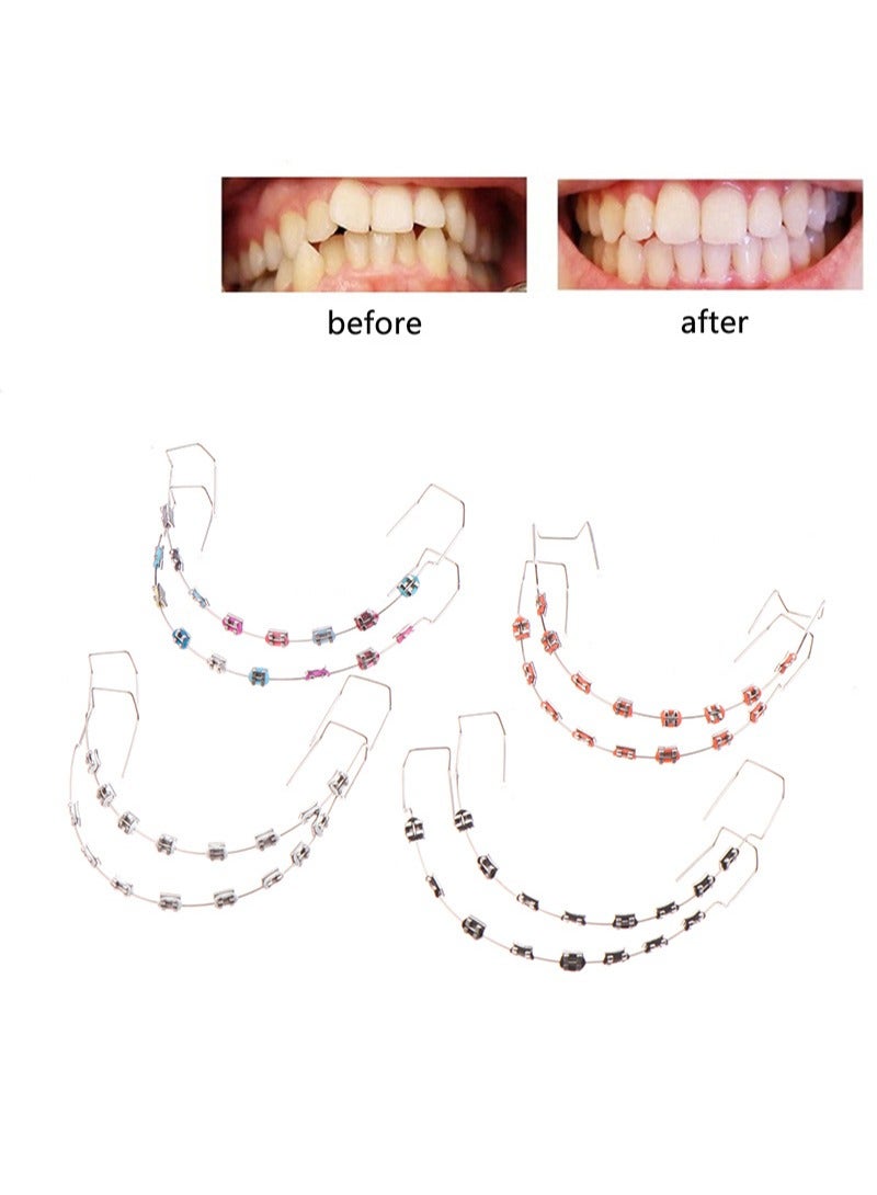 هالونهي زخارف أسنان مؤقتة بأسلاك معدنية، وأقواس معدنية، وأربطة تقويم الأسنان، وأدوات لشرح تقويم الأسنان، وأدوات لطلاب طب الأسنان للتدرب (ملونة) - Image 3